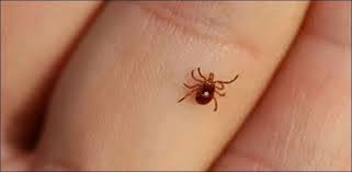 کراچی میں کانگو وائرس سے ایک اور شخص جاں بحق